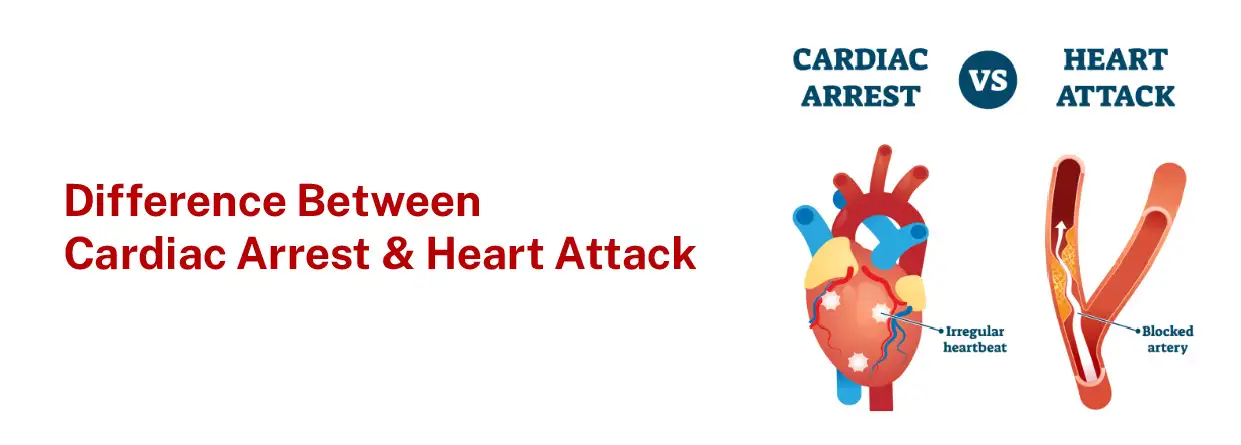 Difference between cardiac arrest and Heart Attack